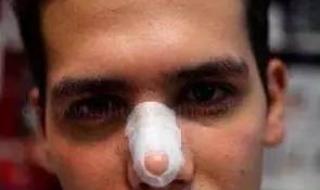 整形鼻子需要多少钱 整形鼻子需要多少钱